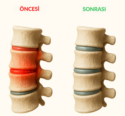 DermaYastık(ısıtma ve masaj destekli)